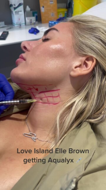 Love Island star Ellie Brown got liposuction in her NECK